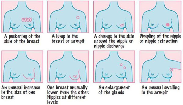 CANSA breast cancer warning signs