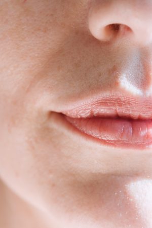 dry lips dr alek nikolic