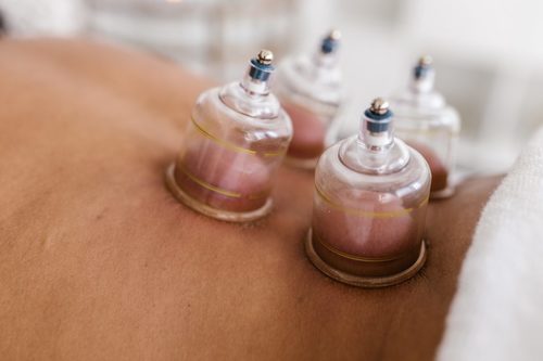 Cupping therapy, wet vs dry: what’s the difference?