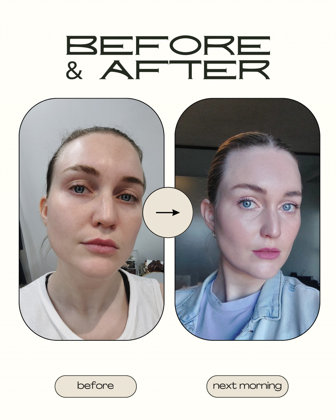 Skin Republic’s Anti-Wrinkle Smooth Patches: a review