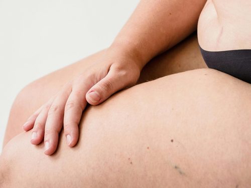 3 natural remedies for dark inner thighs and underarms