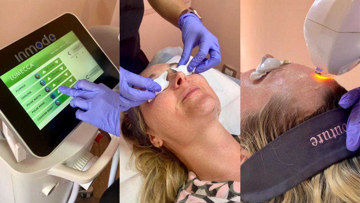 Future-Proof Your Skin: My LUMECCA™ IPL Experience