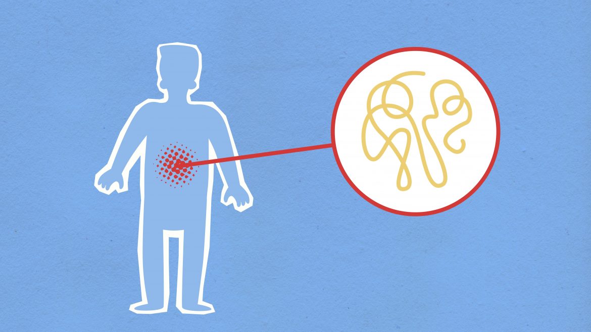 What is emotional inflammation? And how to treat it