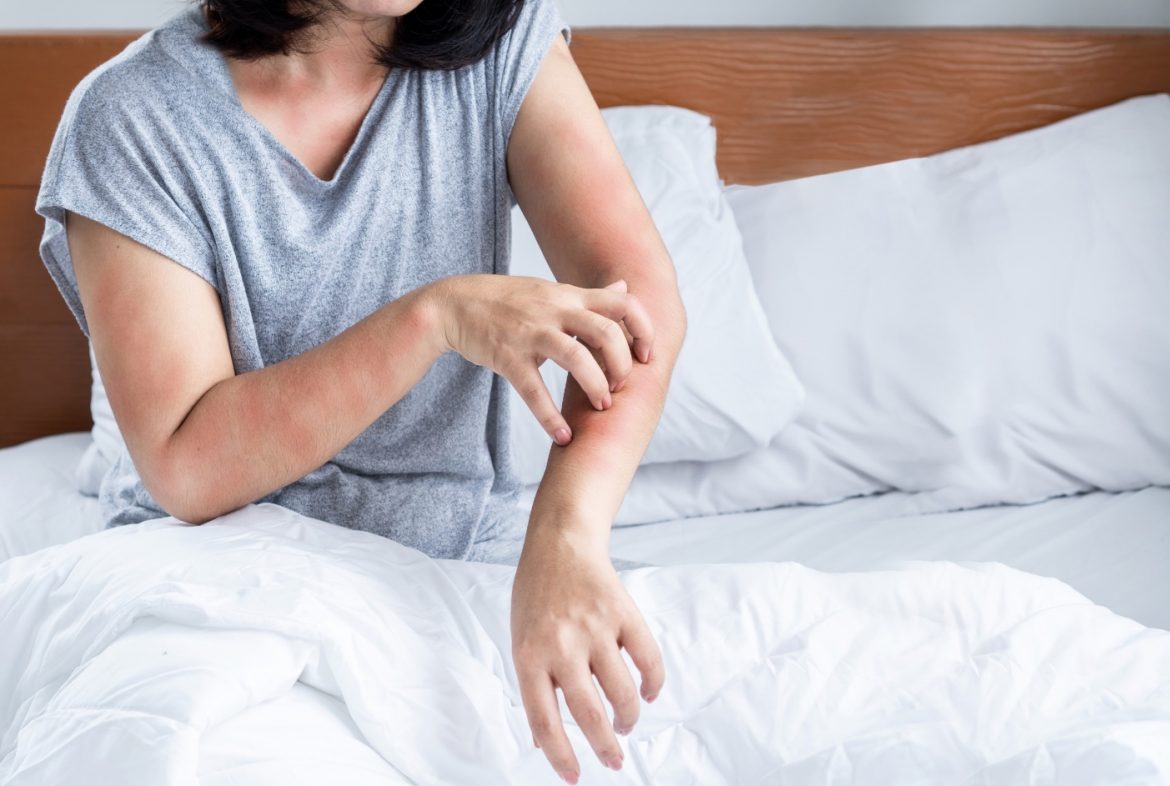 You might have a candida overgrowth – here’s how to cleanse it