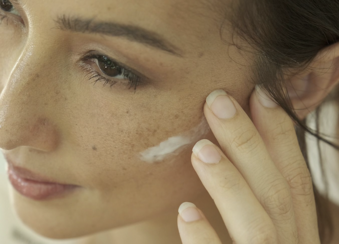 Everything you need to know about hyperpigmentation