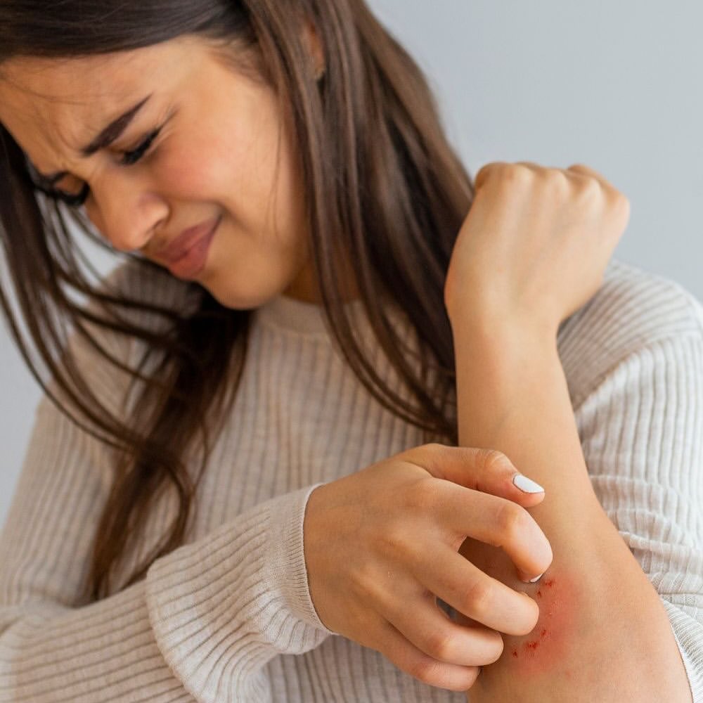 5 At-home treatments to sooth the effects of eczema and psoriasis