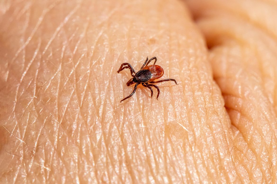 How to remove a tick safely