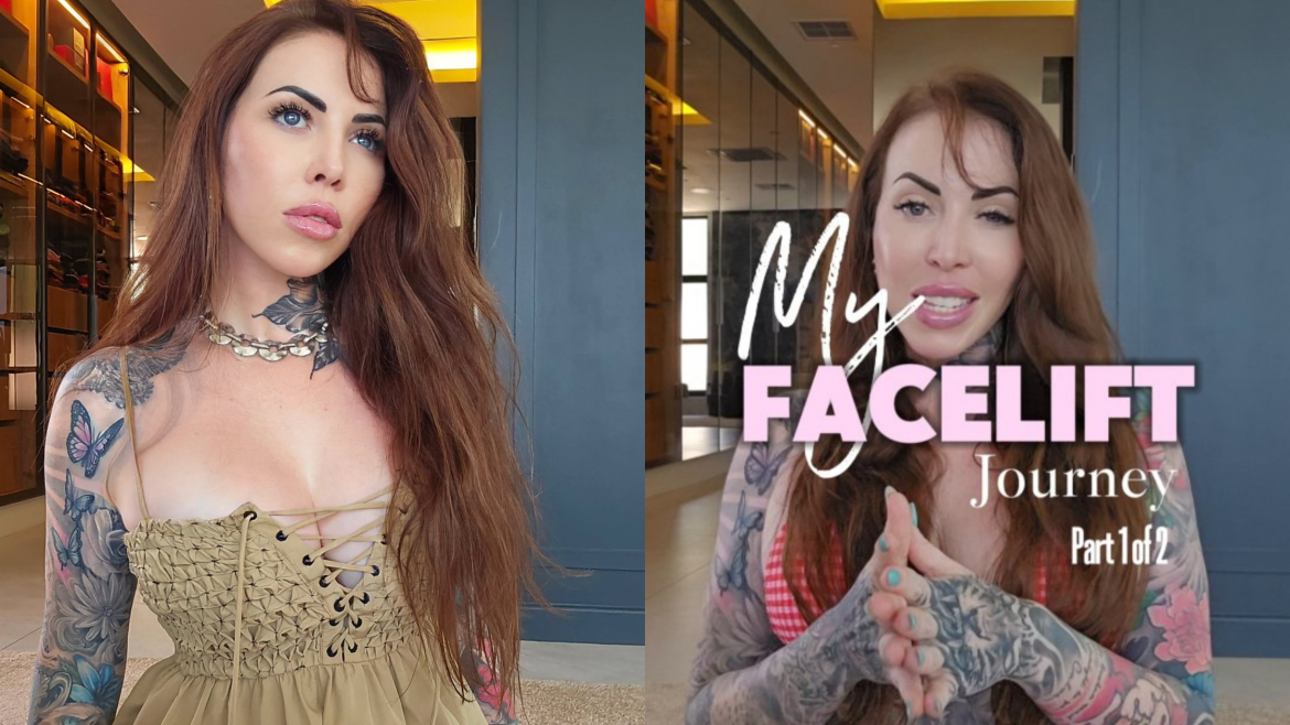 Jojo Robinson gets candid about facelift journey