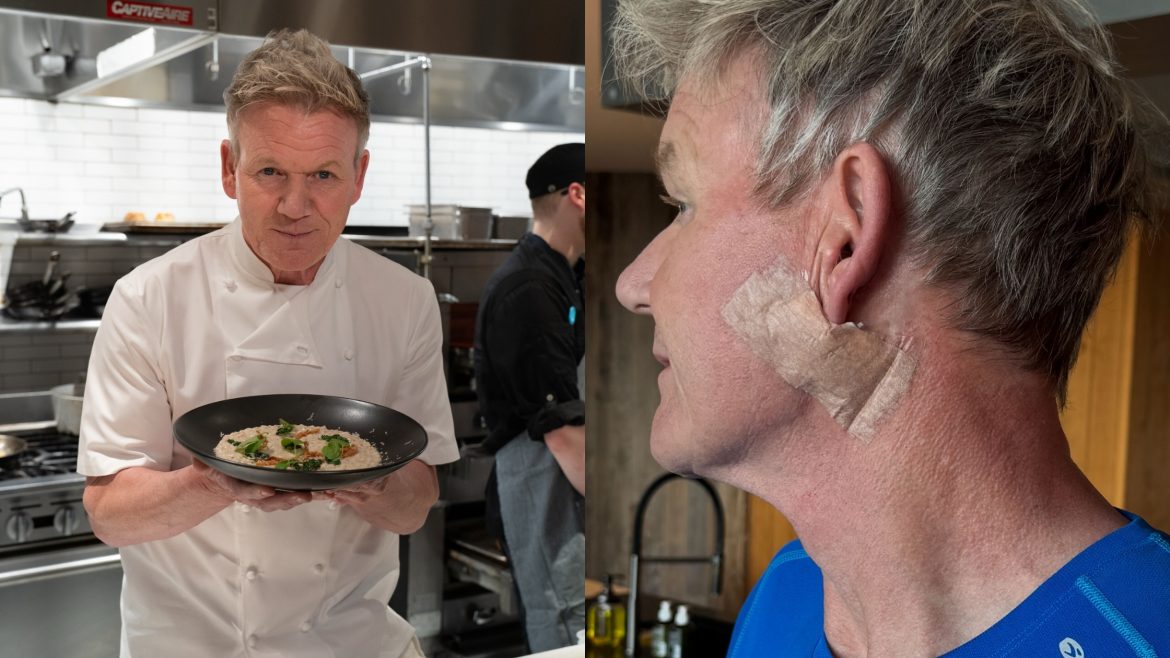 Gordon Ramsay reveals skin cancer diagnosis and urges fans to take sun safety seriously