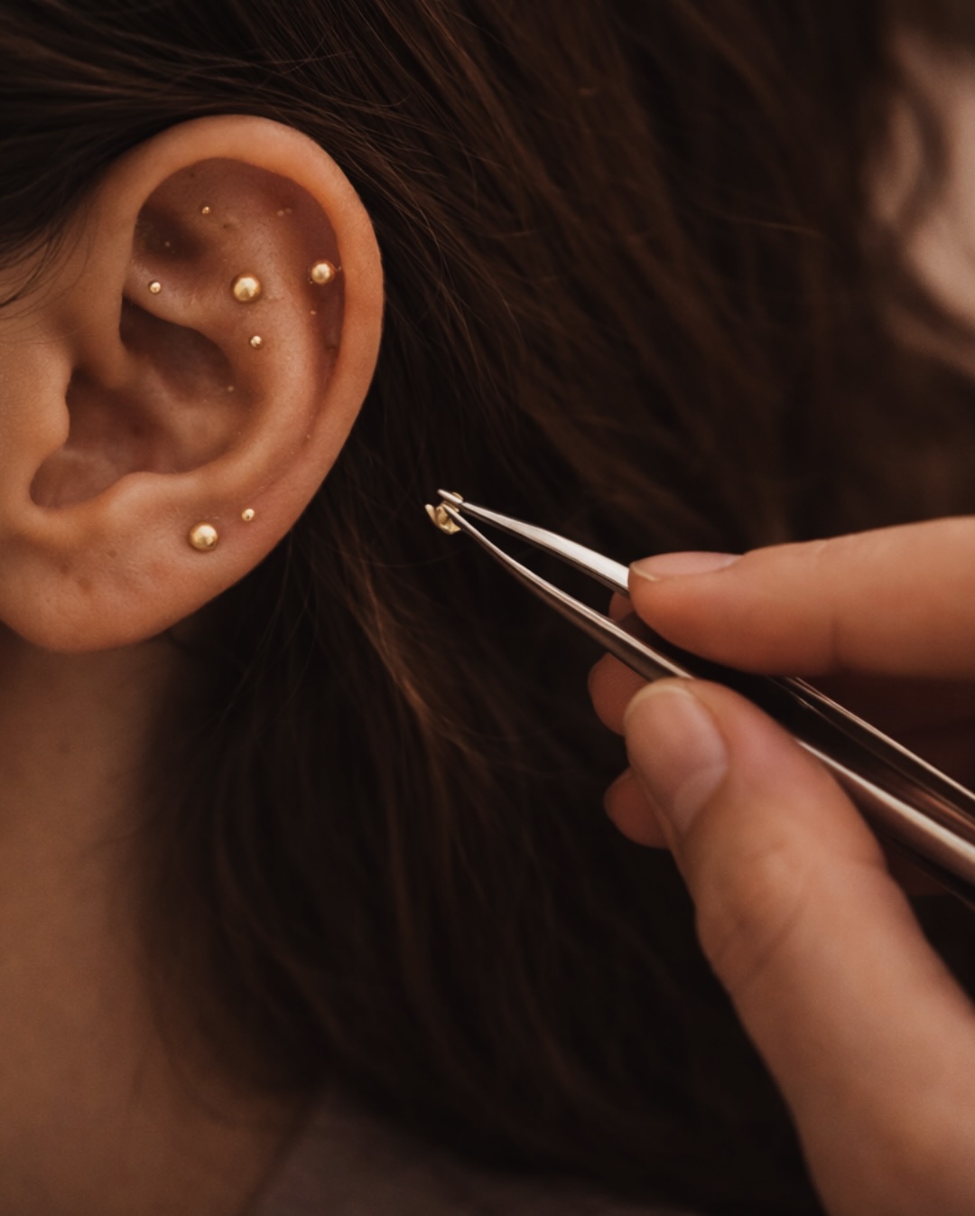 Everything you need to know about ear seeding