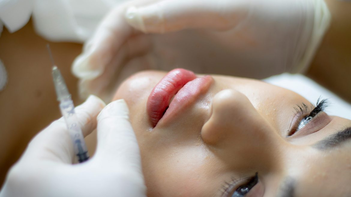 This possible risks of a lip lift that nobody tells you
