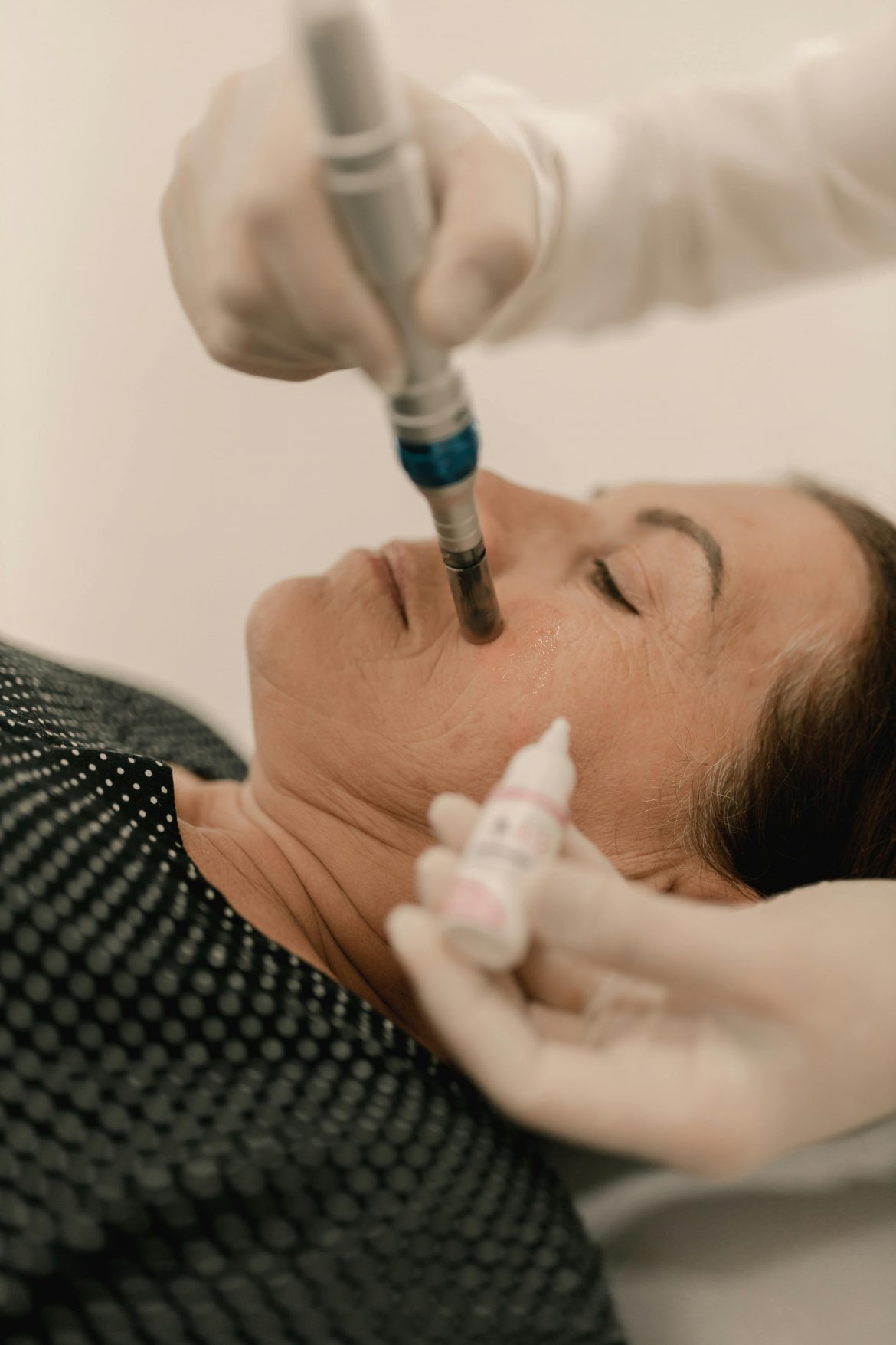 Everything you should know about micro-needling